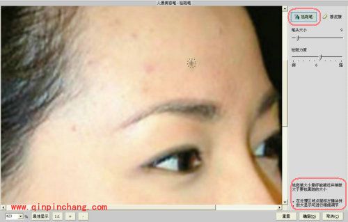 iSee图片专家如何祛除脸上痘痘