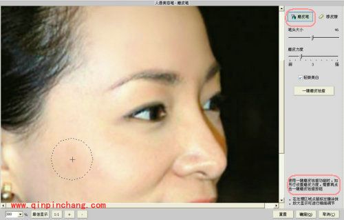iSee图片专家如何祛除脸上痘痘