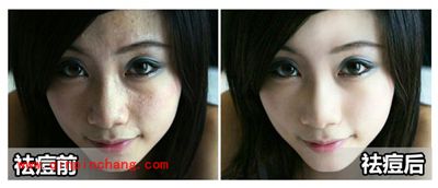 美图秀秀磨皮功能,帮你消灭烦人痘痘