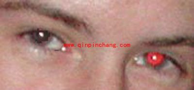 照片红眼太烦人 iSee还你原来&ldquo;眸&rdquo;样