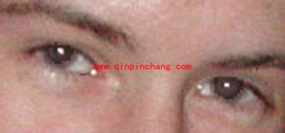 照片红眼太烦人 iSee还你原来&ldquo;眸&rdquo;样