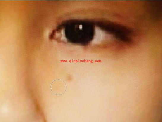 PS使用小妙招:快速去除脸上的痘痘