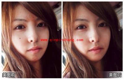 美图秀秀消除笔 水印、痘痘去无踪