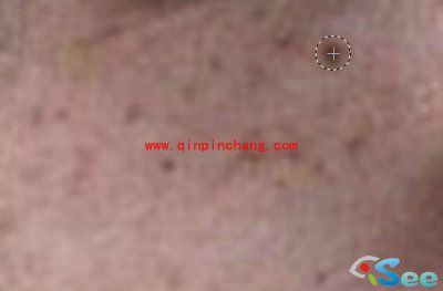 巧用iSee图片专家祛除脸上雀斑教程