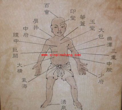 侠客风云传咳嗽扎什么穴位?侠客风云传咳嗽扎穴治疗攻略