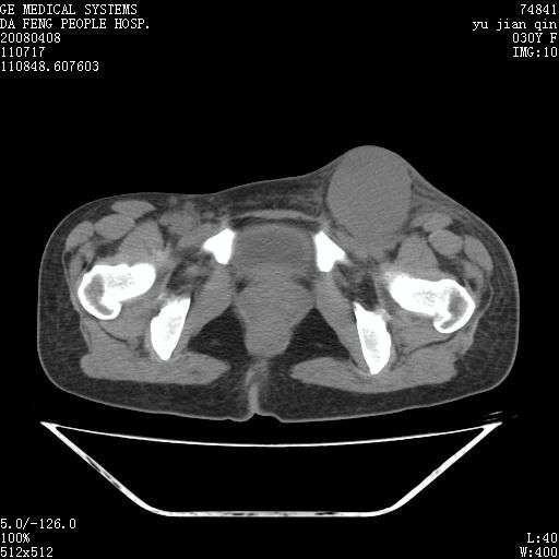 ASP.NET MVC 3 官方安装包