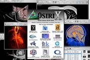 OsiriX For Mac 5.9