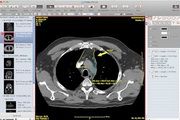 Escape Medical Viewer For Mac 4.4.3